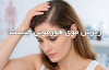 علائم ریزش مو هورمونی در زنان | روش های درمان و تشخیص